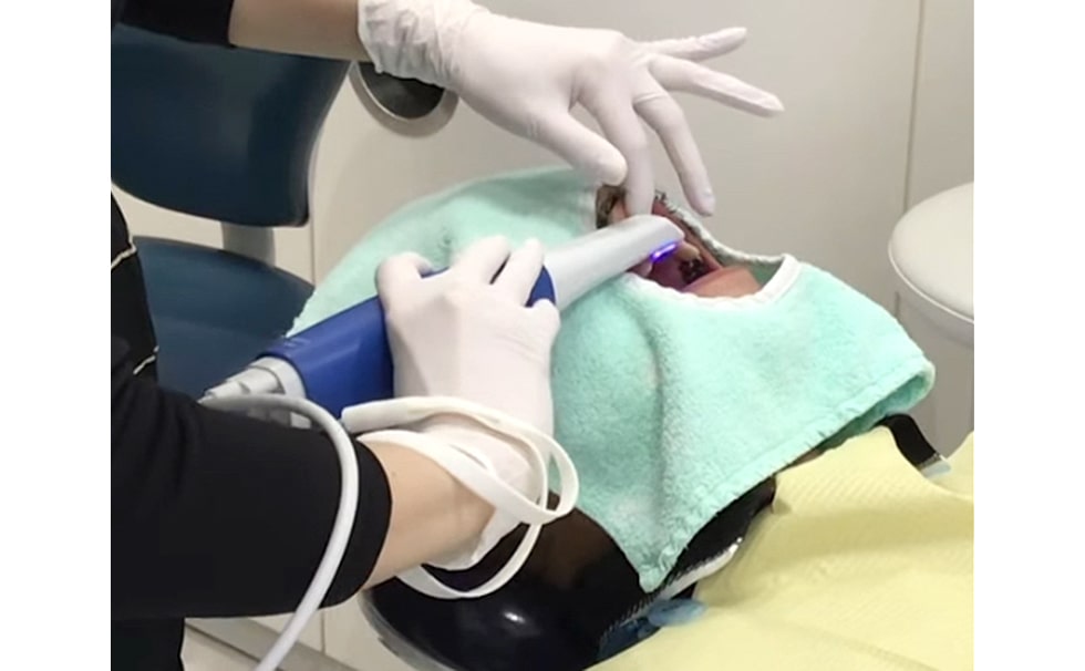 デジタルスキャンの様子